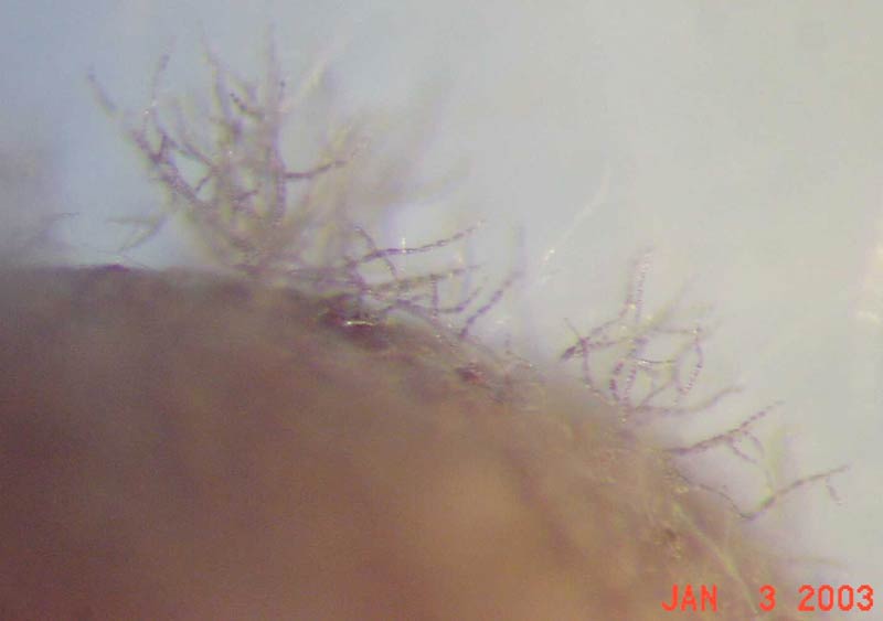 Photo of chains of spores of Alternaria brassicicola growing from an infected cabbage seed.