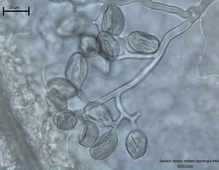 Photo of sporangiophore and sporangia of Peronospora farinosa f. sp. spinaciae.