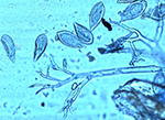 Microscope image of antler-shaped sporangiophores and lemon-shaped sporangia of the onion downy mildew pathogen, Peronospora destructor. Photo source: Lindsey du Toit, Washington State University.