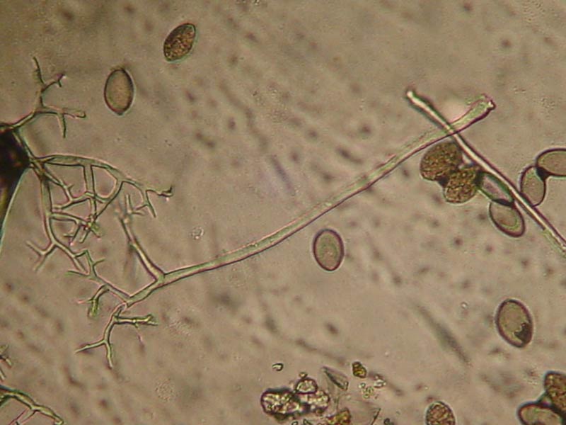 Microscopic photo of the sporangia