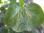 Silvering/stippling and browning of veins on the lower bean leaf surface as a result of severe thrips feeding injury.