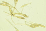 Photo of spores of Alternaria brassicae