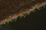 Photo of cercospora carotae under microscope