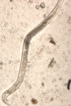 pea-root-lesion-nematode-1