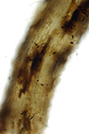pea-thielaviopsis-root-rot-6