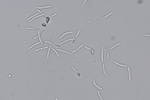 Photo of two-celled hyaline spores of Ramularia beticola